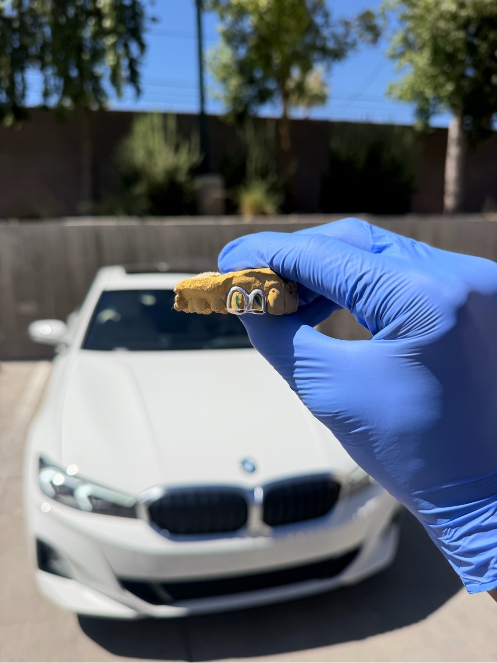 Custom Grillz Mold Kit – Start Your Custom Grillz Order – $150 Deposit